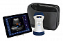 Система ультразвуковая диагностическая ЕЛС500Мини 2в1 (беспроводная: конвексная+линейная)